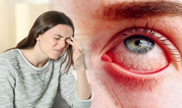 Pink eye Symptoms felt 1559327